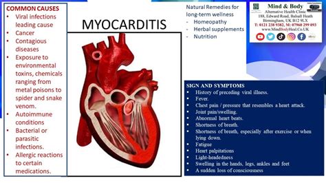 Myocarditis Mind And Body Holistic Health Clinic