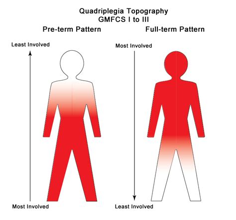 Cerebral Palsy Spastic Quadriplegia Gmfcs Level I Iii Karen