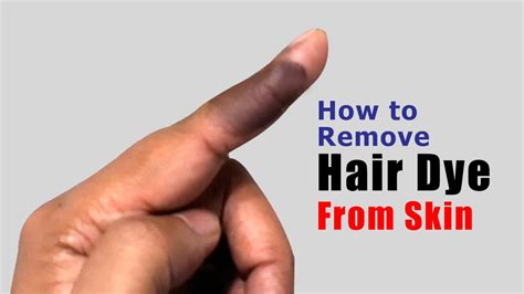 How To Remove Hair Dye From Skin Easy And Effective Method Youtube