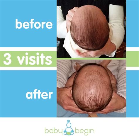Pin On Baby Begin Before And After