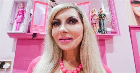 Woman Underwent 100 Surgeries In Her Quest To Become A Barbie Small Joys