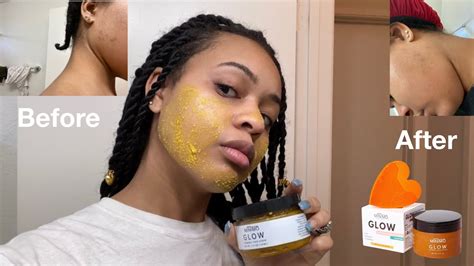 I Tried The Minimo Glow Turmeric Scrub For Hyperpigmentation Here Are