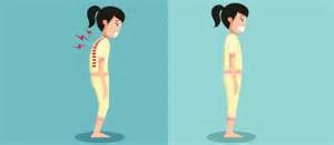 Super Easy And Simple Exercises That Will Improve Your Posture Women