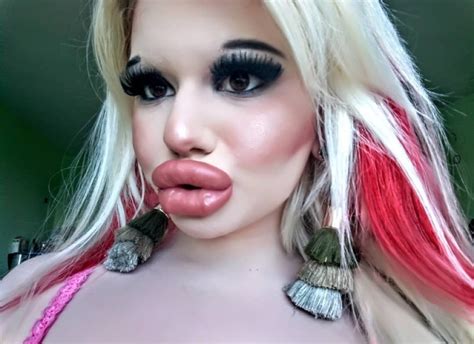 The Woman With The Biggest Lips In The World Is Going To Enlarge Her Cheeks Pictolic