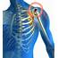Pain Management Aid Shoulder Joint  Causes Treatment And