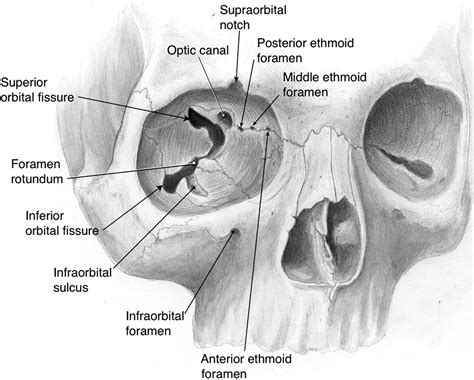 The Subfrontal Approach To The Anterior Skull Base Operative