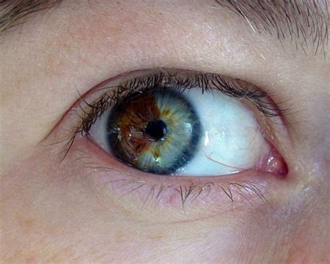 Turn Brown Eyes Blue This Crazy And Only Takes 20 Seconds But Its 5000 Rare Eyes Eye