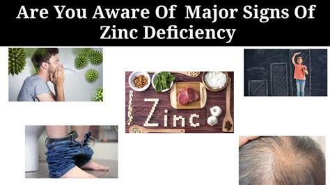 5 Major Signs Of Zinc Deficiency In Your Body Youtube