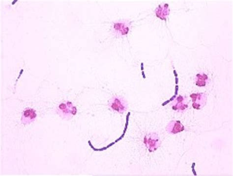 Gram Positive Rodsbacillus Listeria Corynebacterium And Related