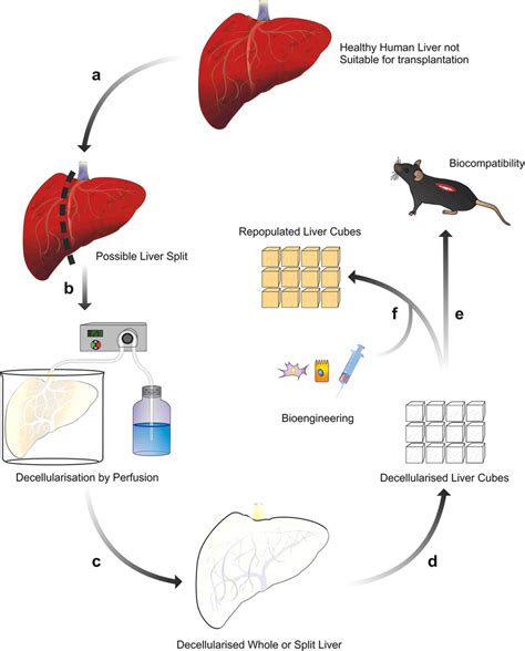 Schematic Study Plan Human Liver Unsuitable For Transplantation Is