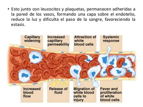 Alteraciones Vasculares En La Inflamacion