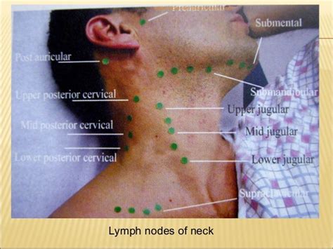 Lymphatics Of Head Neck And Face Dental Crown And Bridge Courses