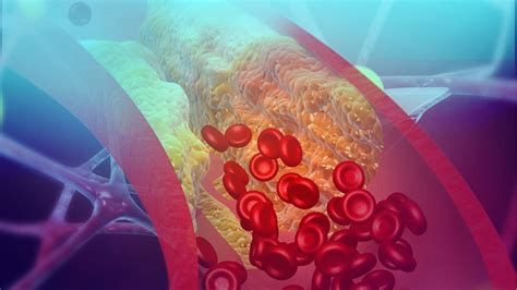 7 Common Signs And Symptoms Of Blood Clots Lifestyle Goals