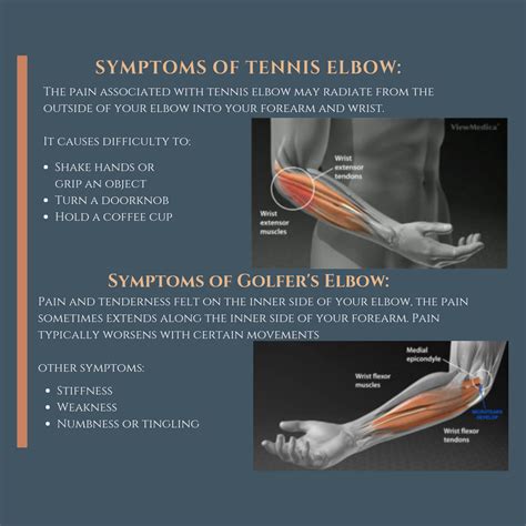 Casecon Tennis Elbow Lateral Epicondylitis And Golfers Elbow Medial