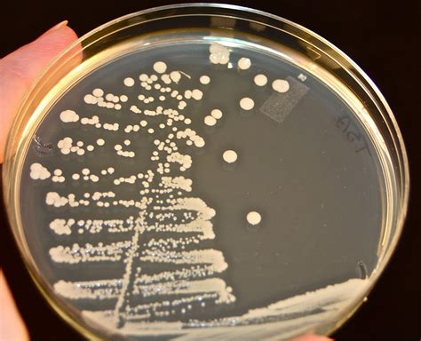 Uma Colonia De Bacterias Isolada Para Cultura Se Reproduz