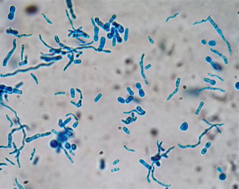 Direct Examination From Trichosporon Culture Hyaline Septate Hyphae