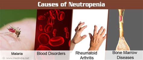Neutropenia Causes Symptoms Diagnosis Treatment And Prevention