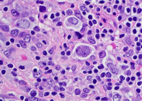 Pathology Outlines Anatomy Histology Larynx And Hypop - vrogue.co