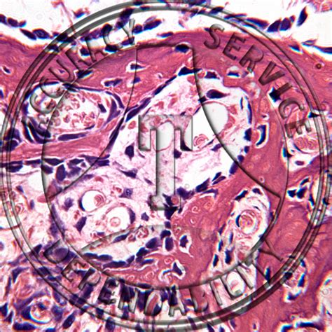 Intramembranous Bone Prepared Microscope Slide