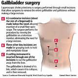 Gallbladder Doctor Near Me Images