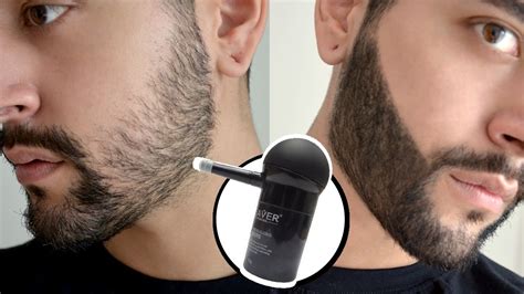 Patchy Beard Solution