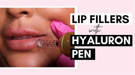 No Needle Lip Filler With Hyaluron Pen Procedure And Aftercare Ft