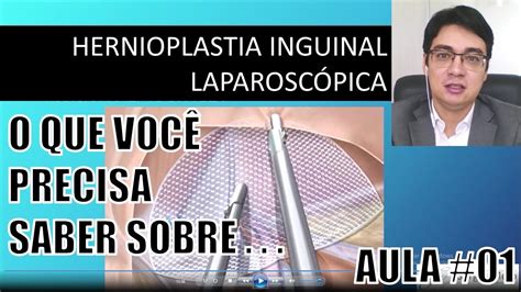 Hernia Por Video Abc Da Hernioplastia Inguinal LaparoscÓpica Dr