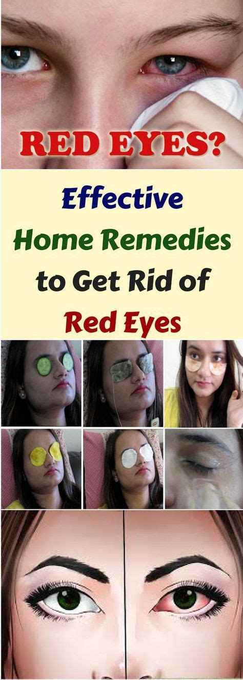 Effective Home Remedies To Get Rid Of Red Eyes Wieghtloss