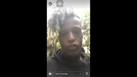 Xxxtentacion Gets Black Eye Jumped By Migos Xxxtentaction Beaten Up By Offset Migos Youtube