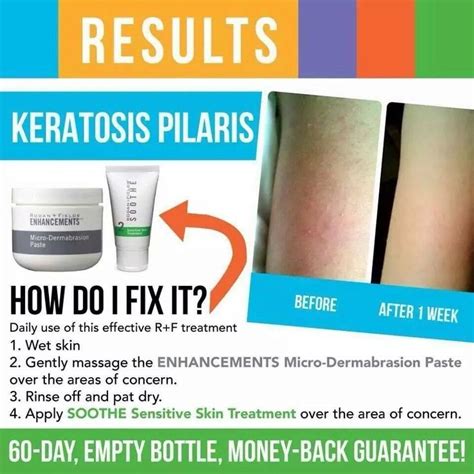 Here are the most effective treatment options, according to dermatologists. How I Fixed My Keratosis Pilaris