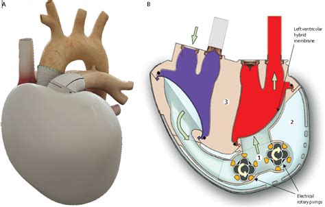 The Carmat Bioprosthetic Total Artificial Heart Download Scientific