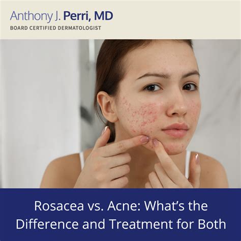 Acne Types And How To Treat Them Perri Dermatology