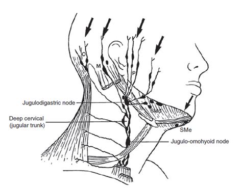 Sinus Lymph Nodes