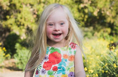 How To Raise A Child With Down Syndrome Advice And Resources