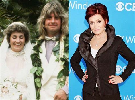 Sharon Osbourne And All Of Hers Plastic Surgery Procedures