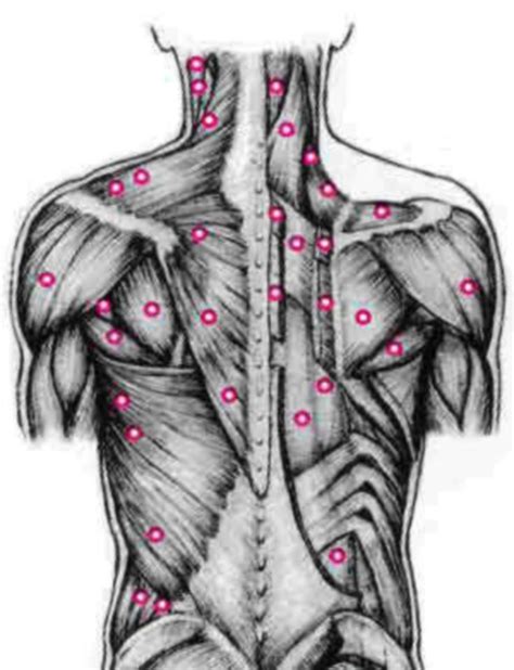 Effective Trigger Point Therapy For Muscle Knots Trigger Point