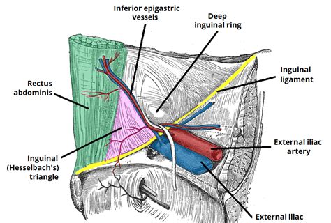 Diagram Of Male Groin Area Surgical Options In The Management Of