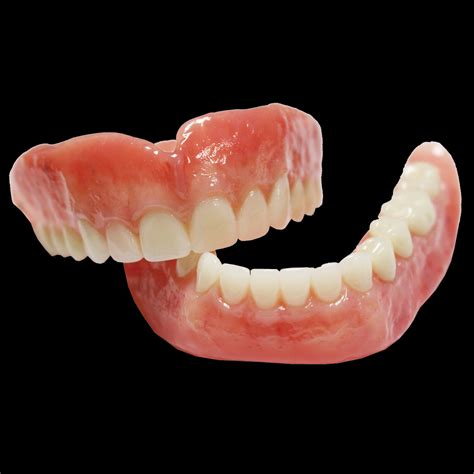 Full Dentures - Ottawa Dental Laboratory