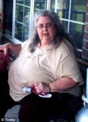Obese Grandmother Who Ate 3 850 Calories A Day In Snacks Alone Drops