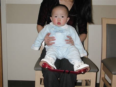 Move your baby's foot into a correct position and then place it in a cast to hold it there. 1000+ images about Clubfoot on Pinterest | Physical ...