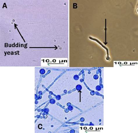 Candida Albicans Microscope Slide