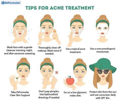 Cystic Acne Types Causes Symptoms Diagnosis Prevention 42 Off