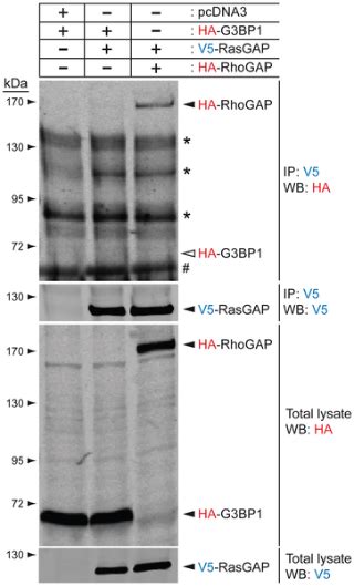 Revisiting G3bp1 As A Rasgap Binding Protein Sensitization Of Tumor