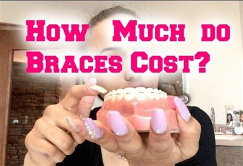 How Much Do Braces For Adults Cost Brier Creek Orthodontics