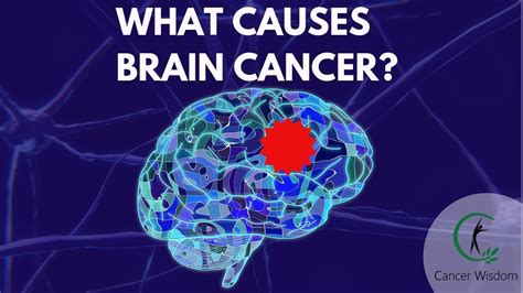 Can Brain Cancer Be Cured Naturally Discover Common Brain Cancer