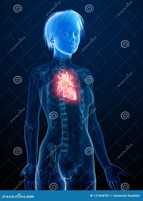 An Inflamed Heart Stock Illustration Illustration Of Internal 127848781