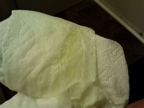Tmi Warning Discharge Or Mucus Plug Pic Included Babycenter