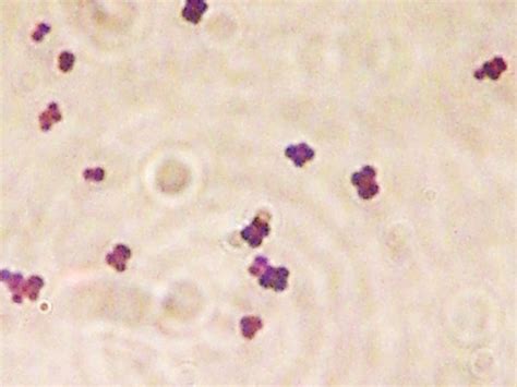 Gram Positive Cocci In Clusters 10 Best Images About Staphylococcus