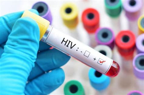 Logran Curar A Un Paciente Con VIH Por Segunda Vez En La Historia Notas De Actualidad