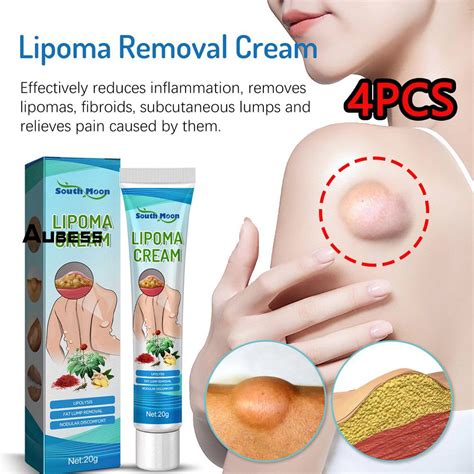 4pcs South Moon Lipoma Removal Cream Lipolysis Fat Lump Relief Plaster
